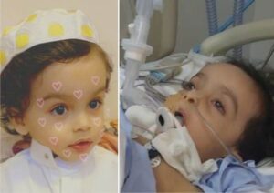Saudi toddler dies after Covid-19 swab test stick breaks inside his nose